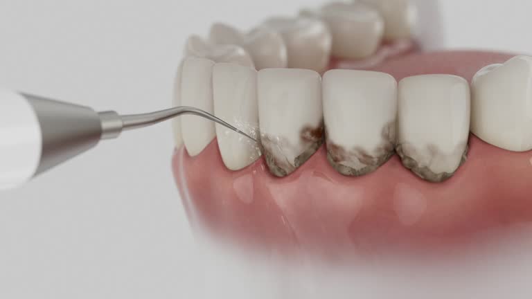 Reliable Dental Implants contractor in Cherryville, PA by Smile Center Dentistry